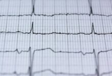 dynamic infinity pulse circuit